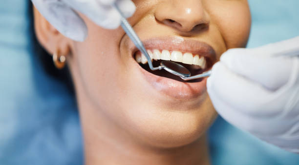 Best Root Canal Emergency Dentist  in Frederickson, WA