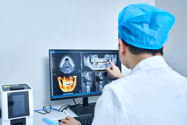 Best Chipped Tooth Repair Near Me  in Frederickson, WA